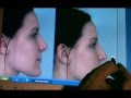 Dr. Steven Dayan performs rhinoplasty computer imaging