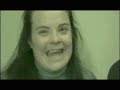 Down syndrome:&nbsp;S�ndrome de Down: Gala del D�a Mundial 