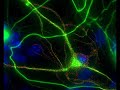 Hippocampal Neuron in 3D rotation_2 Hippocampal Neuron in 3D rotation_2