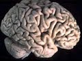 Brain  Lecture 5 Temporal Lobe Schizophrenia Hallucination