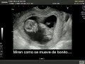 Ecografía de mi Sarita 4 meses de Gestación Ecografía de mi Sarita 4 meses de Gestación