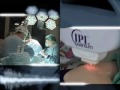 Terapia fotodinamica (PDT) in acnee si precanceroze cutanate
