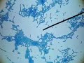 Bonnie Bassler discovers Quorum sensing