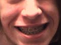 Braces!- Crazy sex ends in tears!
