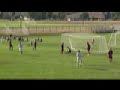 Hope v Olivet assist