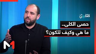 حصى الكلى.. ما هي وكيف تتكون؟
