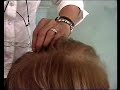Hair Transplant -- medically recommended -- HairCubed.COM spra Hair Transplant -- medically recommended -- HairCubed.COM spra