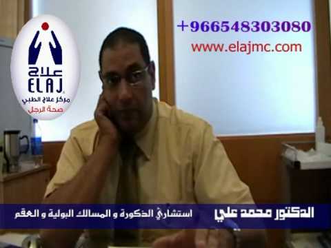 خصية