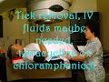 cardiovascular & lymphatic infections part4