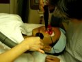 ReviewAntiAging.com - Laser Treatment video of the Q-Switched Nd-Yag Laser Treatment.