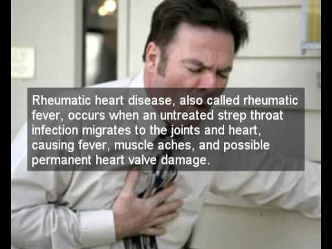 how to treat rheumatic heart disease