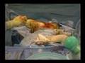Breast Augmentation Surgery