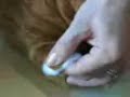 Home blood glucose testing