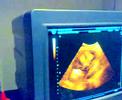Maria Eduarda Caroni Schmitt