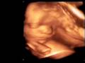 videos de VAlentin 4d 28 semanas