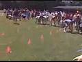 Operation Olympics (Ethicon)