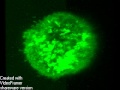 KG1A cell expressing CXCR4-GFP.avi
