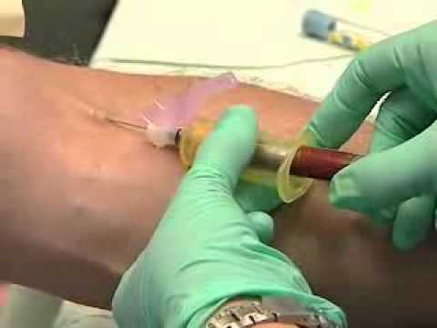 how to collect venous blood gas