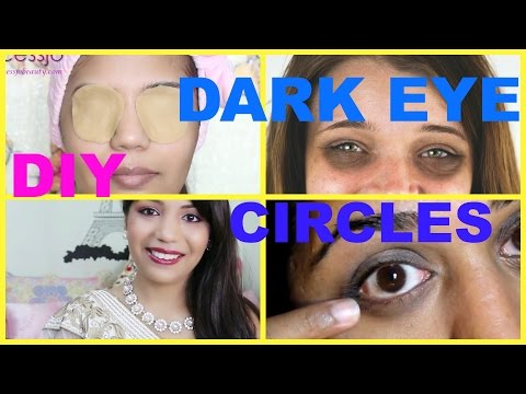 how to cure dark circles