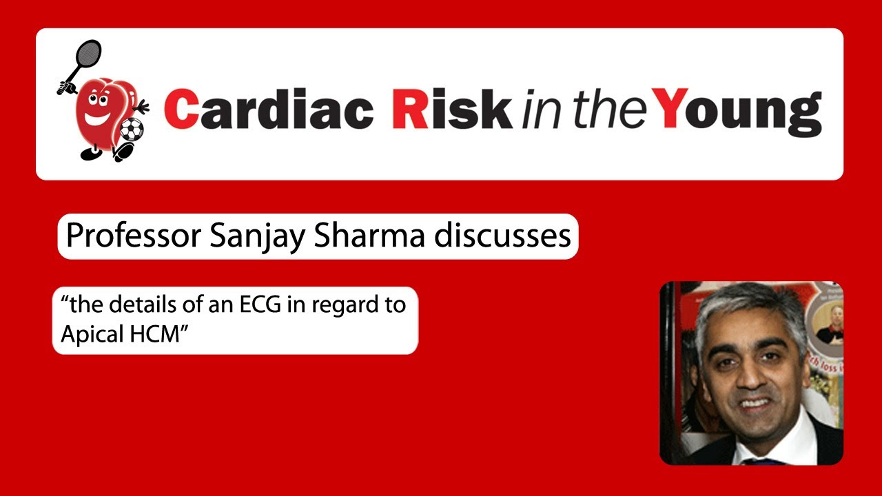 ECG 4: Apical HCM