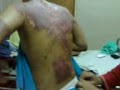 TKW malaysia, korban penganiayaan majikan
