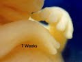 Miracle of Life, fetal development, pro-life Miracle of Life, fetal development, pro-life