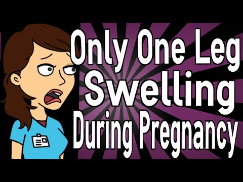 how to relieve oedema during pregnancy