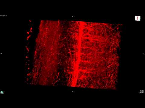 CLARITY - Serotonergic fibers
