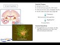 What causes neuronal death in Alzheimer\ What causes neuronal death in Alzheimer\