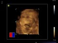 Baby lyric Nyel Baby lyric Nyel