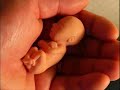 el abortoes un asesinato dentro del vientre