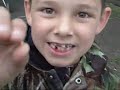 KID SHOOTS OUT LOOSE TOOTH WITH BOW AND ARROW!!!