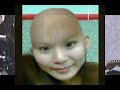Bald Head Gurl