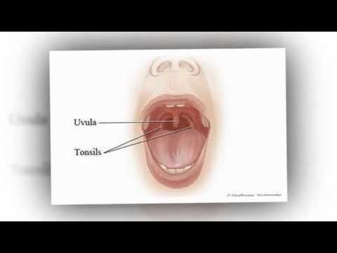 how to cure uvula swollen
