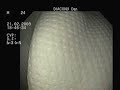 a view inside my stomac