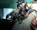 myoma of uterus...Dr.Rahul Krishnadas myoma of uterus...Dr.Rahul Krishnadas