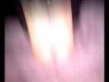 videos de Boob thing in NYC