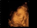 window to the womb 4d baby scan studio
celebrating the miracle of life
4d baby scans from �75.00
tel glenda/jules 0115 8776945
covering all the midlands