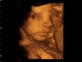 window to the womb 4d baby scan studio
celebrating the miracle of life
4d baby scans from �75.00
tel glenda/jules 0115 8776945
covering all the midlands