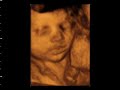 window to the womb 4d baby scan studio
celebrating the miracle of life
4d baby scans from �75.00
tel glenda/jules 0115 8776945
covering all the midlands