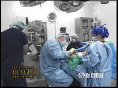 Silicone Implants Interview with Dr. ...