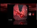 Esophagus Gastric Varices