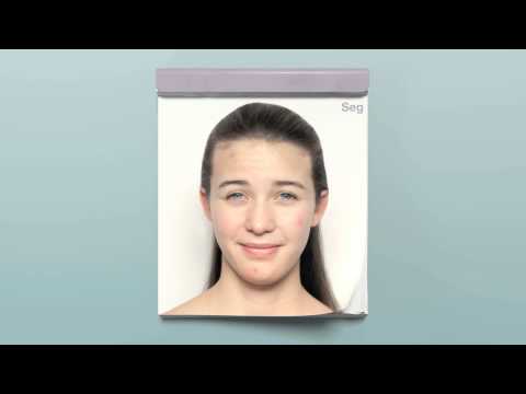 Com Benzac® a acne tem os dias contados | Anúncio de TV - Rapariga