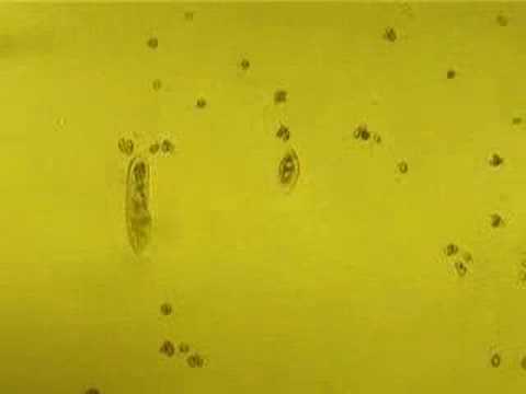 Little protozoa walking