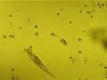 Little protozoa walking