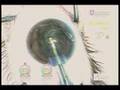 Posterior Polar Cataract Surgery Posterior Polar Cataract Surgery