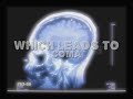 Alcohol youthnoise PSA Alcohol youthnoise PSA