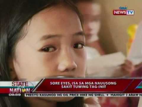 how to cure sore eyes