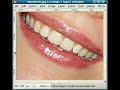 Teeth whitening with GIMP Teeth whitening with GIMP