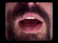 Sociodrama: Uma Tecnologia Social.  Parte 1